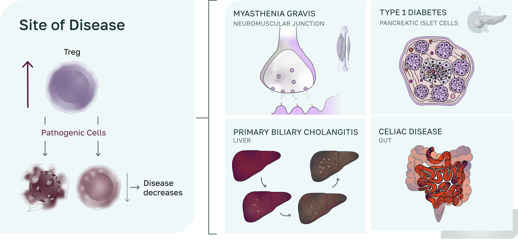 Site of Disease
